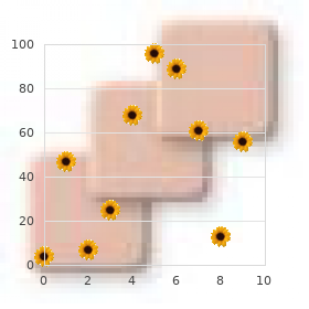 Simpson Golabi Behmel syndrome