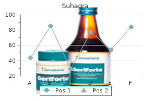 cheap suhagra 100mg fast delivery