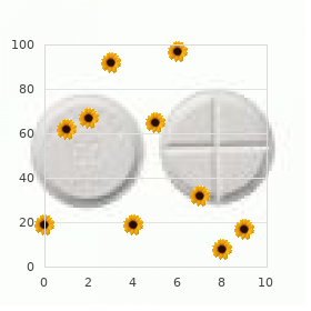 Mental retardation unusual facies talipes hand anomalies
