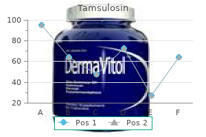 buy 0.2mg tamsulosin fast delivery