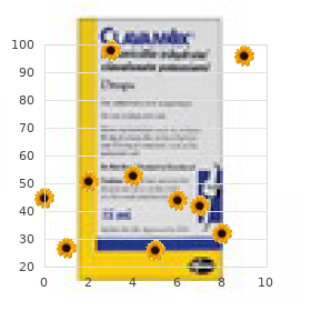 Myopathy ophthalmoplegia hypoacousia areflexia