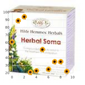 Frontonasal dysplasia