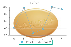 discount tofranil 25mg amex