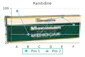 generic ranitidine 300mg otc