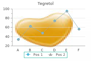 order tegretol 100mg on line