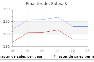 order finasteride 5mg online