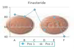 finasteride 1 mg lowest price