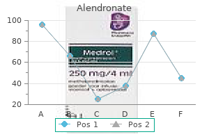 discount alendronate 35 mg fast delivery