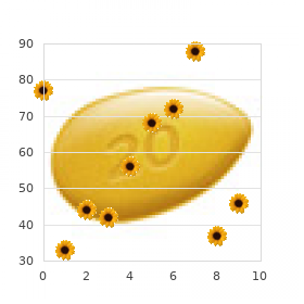 Craniosynostosis Fontaine type