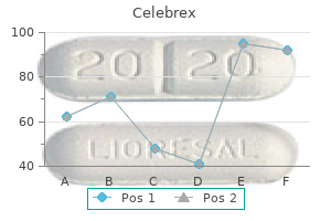 cheap celebrex 100mg on line
