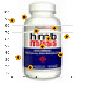 Nephrolithiasis type 2