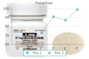 buy fosamax american express