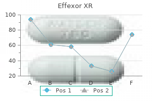 buy effexor xr 150 mg mastercard