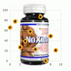 Marphanoid syndrome type De Silva