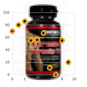 Cleft hand absent tibia