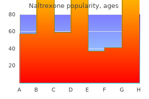 50mg naltrexone with amex