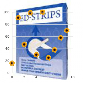 Respiratory acidosis