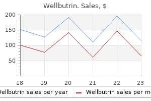 300 mg wellbutrin free shipping