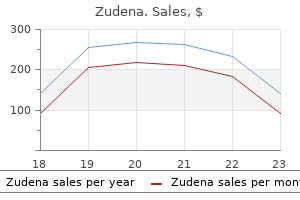 order zudena