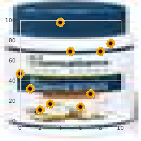 Chromosome 11, partial trisomy 11q