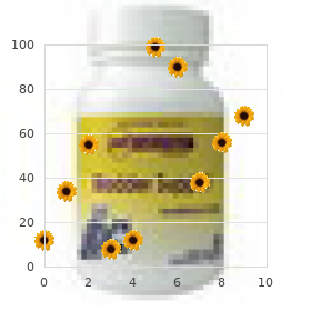 Subependymal nodular heterotopia