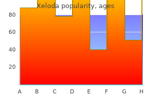 buy generic xeloda pills