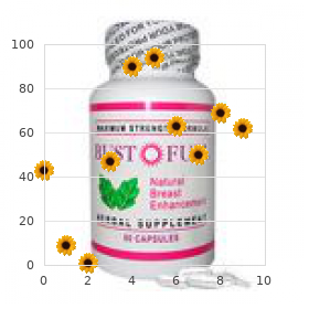 Collins Pope syndrome