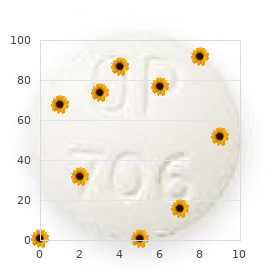 Systemic lupus erythematosus