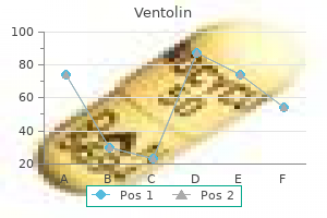generic 100 mcg ventolin with visa