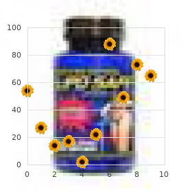 Chromosome 10, trisomy 10q