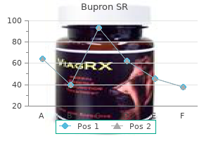 safe 150mg bupron sr