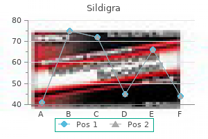 purchase 100 mg sildigra mastercard