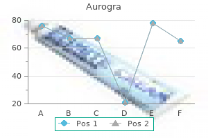 order discount aurogra online