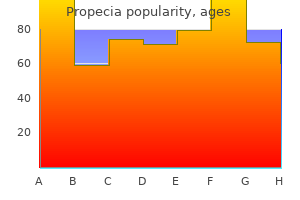 propecia 1 mg purchase with visa