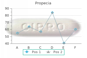 discount propecia 5 mg buy on-line