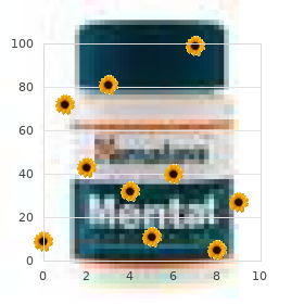 Headache, cluster