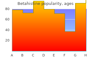 discount betahistine 16mg with visa